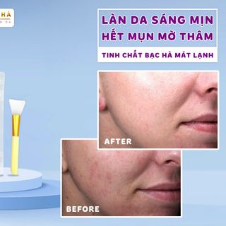 MASK DẺO BẠC HÀ 100GRsản phẩm chuyên dụng trong các Spa cao cấp nè các chị đẹp ơi, ĐẮP TỚI ĐÂU MÁT LẠNH TỚI ĐÓ