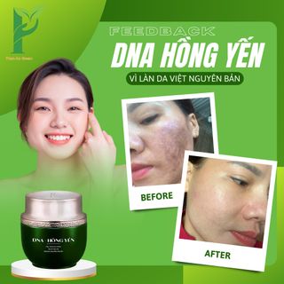 [TẶNG KÈM 1 KEM CHỐNG NẮNG SINH HỌC NINE'S BEAUTY] KEM DƯỠNG DA DNA HỒNG YẾN - PHỤC HỒI, CẤP ẨM, TRẮNG HỒNG & MỊN MÀNG - PHAN AN GREEN