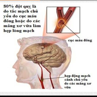 An Cung Ngưu Hoàng Hoàn KWANGDONG Hộp Đỏ 10 viên Chống Đột Quỵ Hàn Quốc Nhập khẩu chính hãng