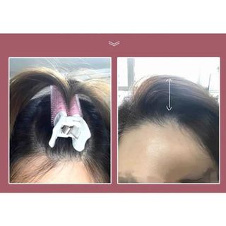 Lô kẹp phồng Tóc mái , top1wow_083992