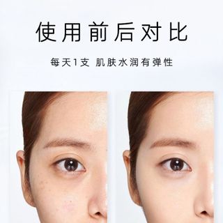 Tinh Chất Cấy Da Natri Hyaluronate,Trietanolamine, cam thảo Glabra, Chiết xuất PRUNUS DOMESTICA, SARGASSUM PALLIDUM, Ức chế hắc tố Melanin, loại bỏ tình trạng xỉn màu, tinh chỉnh làn da, bổ sung độ ẩm, tăng độ đàn hồi và làm trắng, mang lại làn da tươi trẻ, Khỏe Mạnh