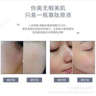 Tinh Chất Natri Hyaluronate, chiết xuất củ LILIUM CANDIDUM, Giúp phục hồi lớp biểu bì da, Cải thiện khả năng miễn dịch của da, tăng cường trao đổi chất, cải thiện tổn thương da, ngăn ngừa sẹo, dưỡng ẩm, làm trắng da.
