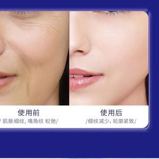 Kem nám Nhật trị nám, tàn nhang, đồi mồi