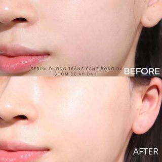 SERUM DƯỠNG TRẮNG BOOM DE AH DAH 10% NIACINAMIDE