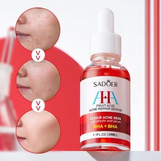Tinh chất serum mụn AHA+BHA thu nhỏ lỗ chân lông làm sáng 30ml SADOER