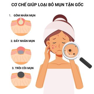 Bộ Tri Mụn ẩn ,Mụn đầu đen,Mụn thâm Doctor Care (serum+ kem )