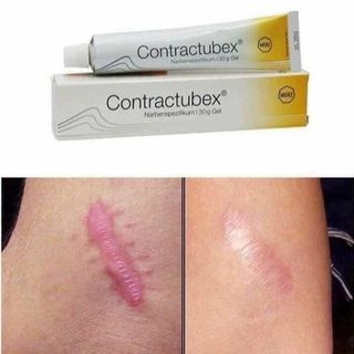 KEM TRỊ SẸO CONTRATUBEX ĐỨC