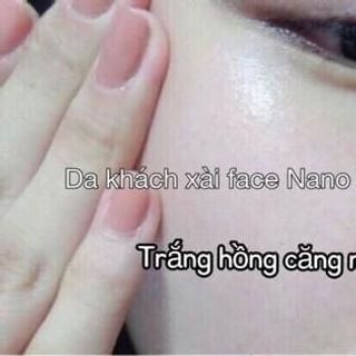 FACE NANO HOA ANH ĐÀO - KEM DƯỠNG TRẮNG DA MẶT NGỪA THÂM NÁM