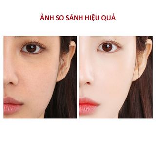 ShowMiracle Srm dưỡng trắng cấp ẩm