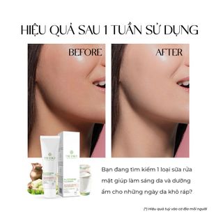 [CHÍNH HÃNG] Sữa rửa mặt sáng da và dưỡng ẩm Truesky Glutathione Cleanser chiết xuất sữa dê 50g - Gía sỉ - Giá bán buôn