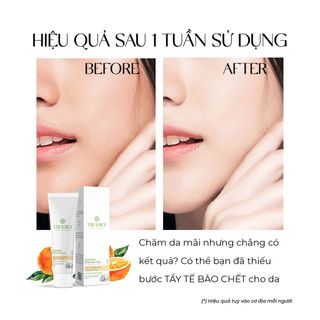 Tẩy tế bào chết da mặt Truesky Orange Peeling Gel dạng gel chiết xuất cam 50g - Giá sỉ - Giá bán buôn