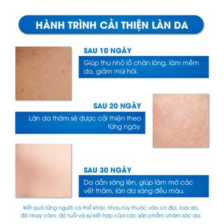 Serum Mờ Thâm Nách, Mông, Thâm Đầu Gối, Khuỷu Tay, Khử Mùi Vùng Nách Oriskin Sakina White Serum 30ml