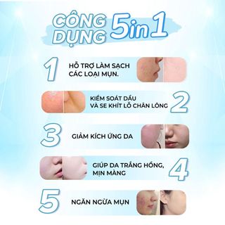 Serum Giảm Mụn Oriskin GenZ White Acne Serum Loại Bỏ Các Loại Mụn Viêm, Trứng Cá Và Mụn Đầu Đen 30ml