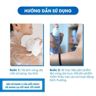 Xịt Mụn Lưng , Ngực , Giảm Mụn Sưng , Mụn Viêm , Mụn Trứng Cá , Giảm Viêm Nang Lông Nữ Oriskin Vicenta Body Mist 100ml