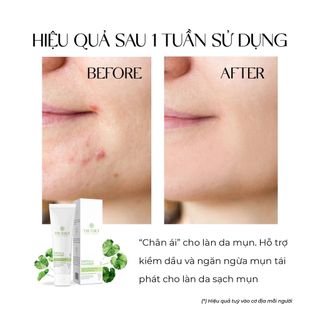 [CHÍNH HÃNH] Gel rửa mặt cho da mụn Truesky Centella Cleanser chiết xuất rau má 50g - Giá bán buôn - Giá sỉ