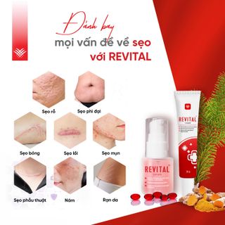 Kem Sẹo REVITAL - Hỗ Trợ Làm Mờ Sẹo, Thâm, Nám, Giúp Dịu Da Cho Làn Da Sáng Mịn, Hồng Hào | Trọng Lượng 30g