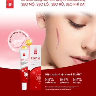 Kem Sẹo REVITAL - Hỗ Trợ Làm Mờ Sẹo, Thâm, Nám, Giúp Dịu Da Cho Làn Da Sáng Mịn, Hồng Hào | Trọng Lượng 30g