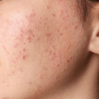 Sữa rửa mặt Compliment No Problem