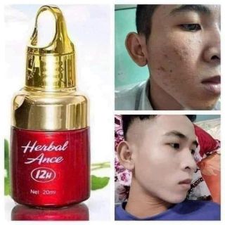 SERUM CHẤM MỤN 12H HĐ