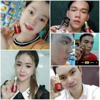 SERUM CHẤM MỤN 12H HĐ