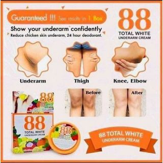 Kem giảm thâm nách total white 88 chính hãng thái lan 35g