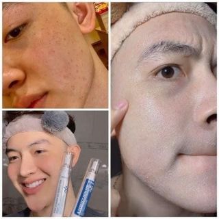 Bộ peel Mocha Retinol