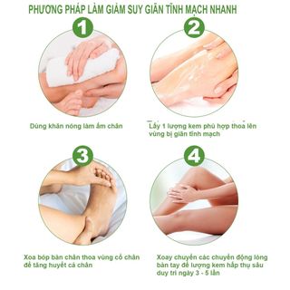 Kem Giãn Tĩnh Mạch Chân Đông Y Thảo Dược Lưu Thông Máu Phục Hồi Giãn tĩnh mạch -30gr