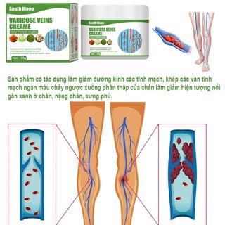 Kem Giãn Tĩnh Mạch Chân Đông Y Thảo Dược Lưu Thông Máu Phục Hồi Giãn tĩnh mạch -30gr