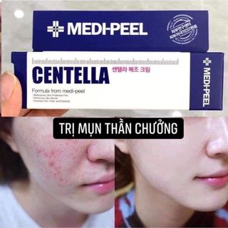 Kem Trị Mụn Phục Hồi Da MediPeel Centella Mezzo Cream