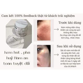 Kem nám Mela Q Dongkook Hàn quốc tem nhãn đầy đủ