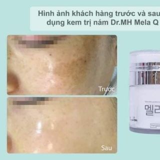 Kem nám Mela Q Dongkook Hàn quốc tem nhãn đầy đủ