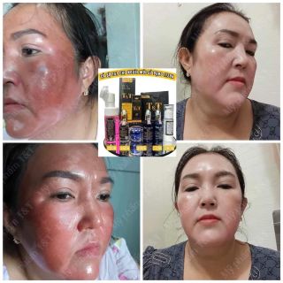 Bộ kem face T&T