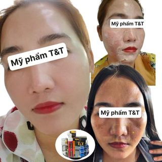 Bộ kem face T&T
