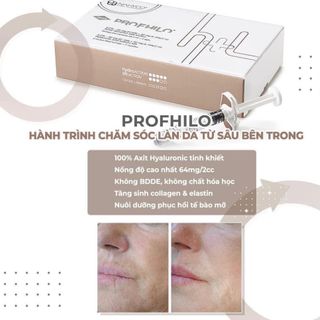 PROFHILO tiêm BAP