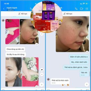 COMBO SÂM TỐ NỮ + GLUTATHIONE 60000