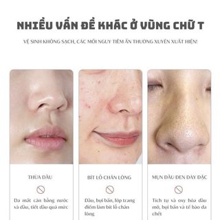 Mặt nạ dạng bột dành cho mũi pore gommage paste pl mụn đầu đen da nhạy cảm
