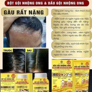 Bột gội nhộng ong - trị gàu, nấm ngứa da đầu