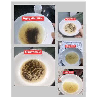 Nước súc miệng trắng răng thơm miệng Dental Care 500g