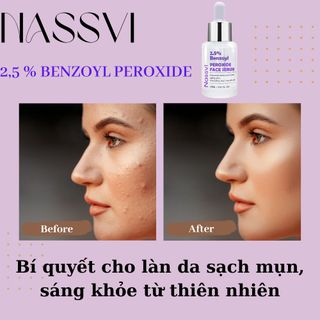 Serum giảm mụn 5 tác động Nassvi 2,5% Benzoyl Peroxide 30ml dành cho da dầu mụn hiệu quả sau 7 ngày