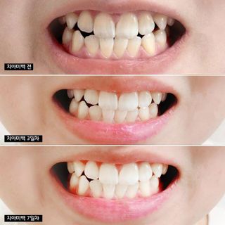 Kem Đánh Răng Median 120gr 93% Thái Lan Xịn (Thùng 36 Tuýp)