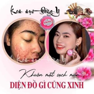 Kem trị mụn hoa anh đào