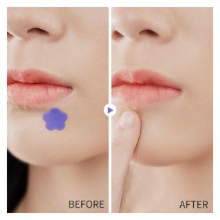 Miếng Dán Trị MỤN Sticker Cực Yêu . Dùng cho các loại mụn. Được sản xuất và bán buôn trong và ngoài nước ( 36mieng/hop ) Hàng, Giá tận Xưởng