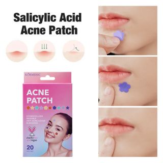 Miếng Dán Trị MỤN Sticker Cực Yêu . Dùng cho các loại mụn. Được sản xuất và bán buôn trong và ngoài nước ( 36mieng/hop ) Hàng, Giá tận Xưởng