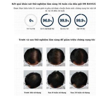 Dầu gội chống rụng tóc số 1 Hàn quốc DR BANGGIWON