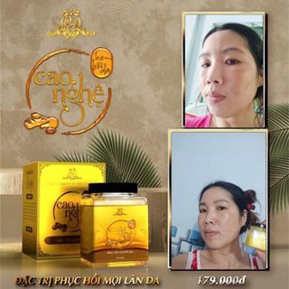 Cao nghệ bôi da phục hồi chuyên sâu collagen x3 Mỹ phẩm đông anh ( chính hãng)