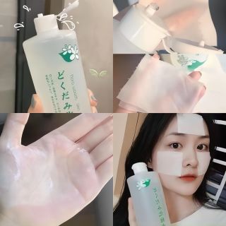 Nước hoa hồng diếp cá trị mụn