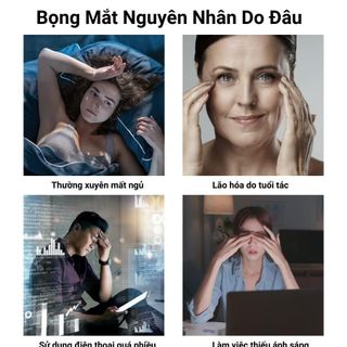 Nạ mắt dưỡng trắng giảm quồng thâm mắt hộp 60 miếng