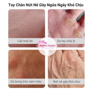 Mặt nạ ủ tay tinh chất sữa dê