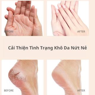 Kem trị nứt gót chân Heyxi Hộp 20gram