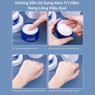 Kem dưỡng ẩm trị viêm nang lông hộp 100gram